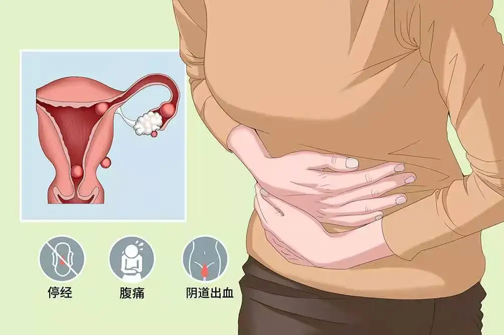 分享宮外孕早期常見的六個征兆，如有發(fā)現(xiàn)需盡快就醫(yī)
