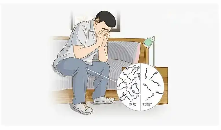 弱精癥的十大表現(xiàn)匯總，看完什么特點(diǎn)都明白了