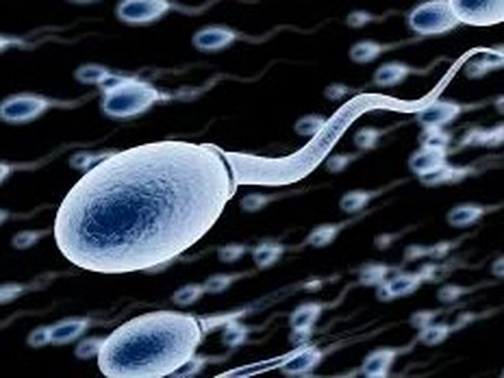 死精子與正常精子有什么區(qū)別?這四個方法治愈死精癥有奇效