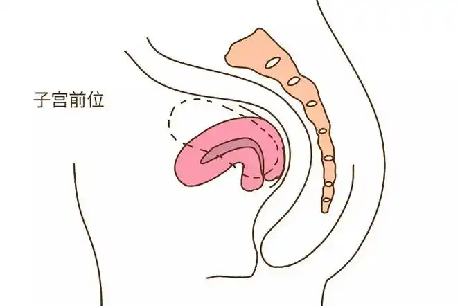 子宮前位容易懷孕嗎?來(lái)看看網(wǎng)友都是怎么說(shuō)的